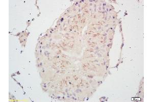 Formalin-fixed and paraffin embedded rat testis labeled with Rabbit Anti PSCA Polyclonal Antibody, Unconjugated (ABIN671676) at 1:200 followed by conjugation to the secondary antibody and DAB staining (PSCA 抗体  (AA 24-123))