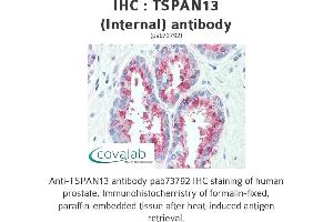 Image no. 1 for anti-Tetraspanin 13 (TSPAN13) (Internal Region) antibody (ABIN1740424) (TSPAN13 抗体  (Internal Region))