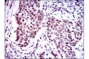 Image no. 1 for anti-Forkhead Box P1 (FOXP1) antibody (ABIN1491561) (FOXP1 抗体)