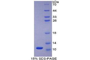 SDS-PAGE (SDS) image for Peptidase Inhibitor 3, Skin-Derived (PI3) (AA 41-117) protein (His tag) (ABIN1080483) (PI3 Protein (AA 41-117) (His tag))