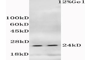 L1 mouse liver, L2 mouse cerebrum lysates probed (ABIN685183) at 1:200 in 4 °C. (HIST1H1E 抗体  (pThr18))