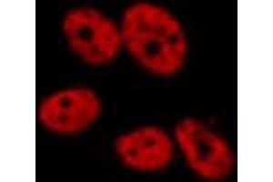 ABIN6277771 staining HeLa by IF/ICC. (CSNK2A1/CK II alpha 抗体  (N-Term))