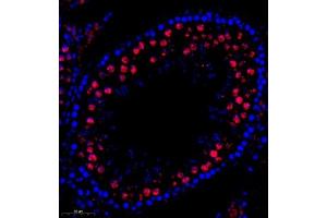 Immunofluorescence of paraffin embedded rat testis using QSK (ABIN7075608) at dilution of 1:600 (300x lens) (SIK3 抗体)