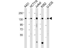All lanes : Anti-TACC3 Antibody (Center) at 1:2000 dilution Lane 1: A431 whole cell lysate Lane 2: HC whole cell lysate Lane 3: Jurkat whole cell lysate Lane 4: K562 whole cell lysate Lane 5: U-2OS whole cell lysate Lysates/proteins at 20 μg per lane.