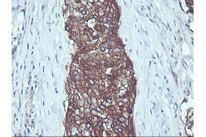 Image no. 1 for anti-V-Ral Simian Leukemia Viral Oncogene Homolog B (Ras Related, GTP Binding Protein) (Ralb) antibody (ABIN1500584) (RALB 抗体)