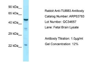 Western Blotting (WB) image for anti-Tubulin, beta 3 (TUBB3) (C-Term) antibody (ABIN2774381) (TUBB3 抗体  (C-Term))