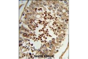 Formalin-fixed and paraffin-embedded human testis tissue reacted with TAC2N Antibody (N-term), which was peroxidase-conjugated to the secondary antibody, followed by DAB staining. (TC2N 抗体  (N-Term))