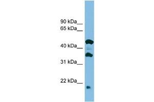 WB Suggested Anti-C11orf73 Antibody Titration: 0. (C11orf73 抗体  (Middle Region))