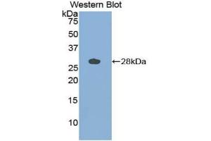 Detection of Recombinant CTSS, Bovine using Polyclonal Antibody to Cathepsin S (CTSS) (Cathepsin S 抗体  (AA 115-331))