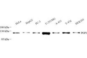 Western blot analysis of POP1 (ABIN7075178),at dilution of 1: 2000