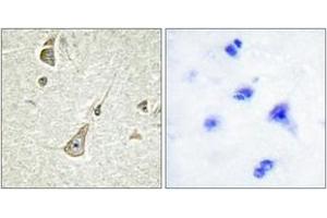 Immunohistochemistry analysis of paraffin-embedded human brain tissue, using PCDH-X/Y Antibody. (PCDH-X/Y (AA 531-580) 抗体)