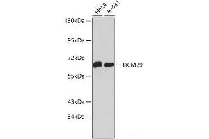 Western blot analysis of extracts of various cell lines using TRIM29 Polyclonal Antibody. (TRIM29 抗体)