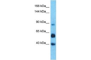 Host:  Rabbit  Target Name:  LRC66  Sample Type:  Liver Tumor lysates  Antibody Dilution:  1. (LRRC66 抗体  (C-Term))
