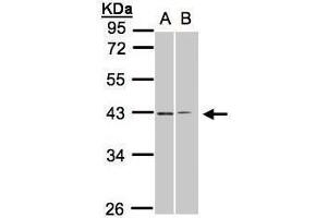 WB Image Sample(30 ug whole cell lysate) A:293T B:H1299 10% SDS PAGE antibody diluted at 1:1000 (GALR2 抗体  (C-Term))