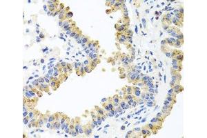 Immunohistochemistry of paraffin-embedded Mouse lung using HSPA6 Polyclonal Antibody at dilution of 1:100 (40x lens). (HSPA6 抗体)