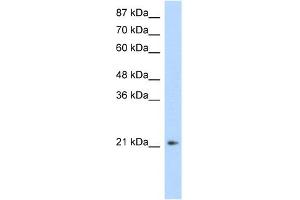 WB Suggested Anti-FERD3L Antibody Titration:  1. (FERD3L 抗体  (N-Term))