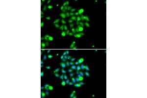 Immunofluorescence analysis of U20S cell using UBE2G1 antibody. (UBE2G1 抗体)