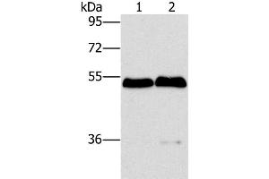 Western Blot analysis of Mouse brain and liver tissue using SPHK2 Polyclonal Antibody at dilution of 1:200 (SPHK2 抗体)