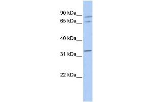 WB Suggested Anti-GJA4 Antibody Titration:  0. (GJA4 抗体  (Middle Region))