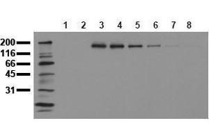 Western Blotting (WB) image for anti-Receptor tyrosine-protein kinase erbB-2 (ErbB2/Her2) (pTyr1112) antibody (ABIN126789) (ErbB2/Her2 抗体  (pTyr1112))