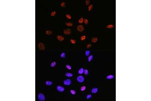 Immunofluorescence analysis of U-2 OS cells using HD Rabbit mAb (ABIN1680476, ABIN3015870, ABIN3015871 and ABIN7101453) at dilution of 1:100 (40x lens). (HDAC9 抗体)