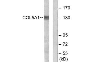 Western Blotting (WB) image for anti-Collagen, Type V, alpha 1 (COL5A1) (Internal Region) antibody (ABIN1850288) (COL5A1 抗体  (Internal Region))