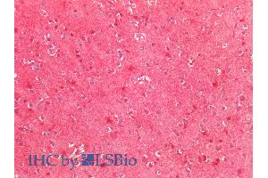 ABIN768567 (5µg/ml) staining of paraffin embedded Human Cortex. (SOD2 抗体  (Internal Region))