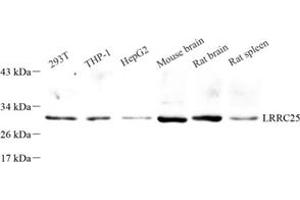 Western blot analysis of LRRC25 (ABIN7074482) at dilution of 1: 500 (LRRC25 抗体)