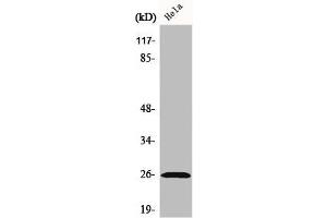 Western Blot analysis of HeLa cells using Ephrin-A5 Polyclonal Antibody (Ephrin A5 抗体  (Internal Region))