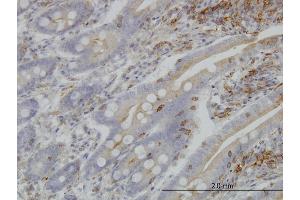 Immunoperoxidase of monoclonal antibody to BFAR on formalin-fixed paraffin-embedded human small Intestine. (BFAR 抗体  (AA 101-200))