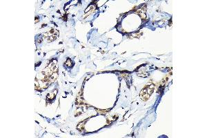 Immunohistochemistry (IHC) image for anti-Ubiquitin Specific Peptidase 5 (USP5) (AA 1-280) antibody (ABIN1683231)