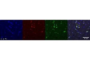 Immunohistochemistry (IHC) image for anti-Oligodendrocytic Myelin Paranodal and Inner Loop Protein (OPALIN) antibody (ABIN7456149) (OPALIN 抗体)
