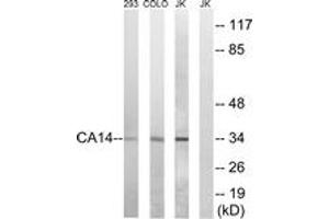 Western Blotting (WB) image for anti-Carbonic Anhydrase XIV (CA14) (AA 161-210) antibody (ABIN2890187) (CA14 抗体  (AA 161-210))