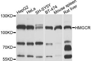 Western blot analysis of extracts of various cells, using HMGCR antibody. (HMGCR 抗体)