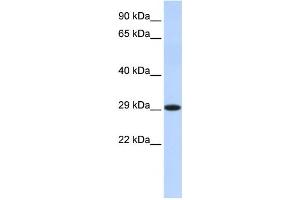 Western Blotting (WB) image for anti-Hydroxysteroid (17-Beta) Dehydrogenase 14 (HSD17B14) antibody (ABIN2459984) (HSD17B14 抗体)