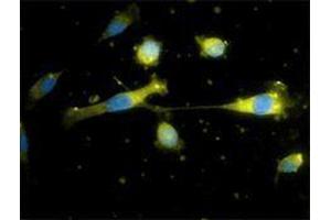 Immunofluorescence (IF) image for anti-CD34 (CD34) antibody (Alexa Fluor 647) (ABIN2657763) (CD34 抗体  (Alexa Fluor 647))