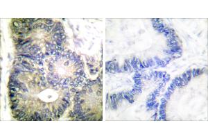 Peptide - +Immunohistochemical analysis of paraffin-embedded human colon carcinoma tissue using Cytochrome c antibody (#C0170). (Cytochrome C 抗体)