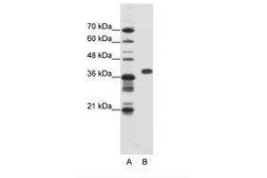 Image no. 1 for anti-Poly(rC) Binding Protein 1 (PCBP1) (AA 201-250) antibody (ABIN202334) (PCBP1 抗体  (AA 201-250))