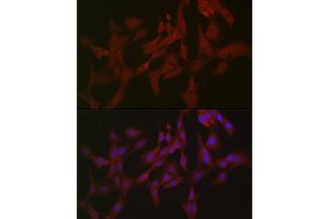 Immunofluorescence (IF) image for anti-Receptor-Interacting serine-threonine Kinase 3 (RIPK3) (AA 1-120) antibody (ABIN6146964)