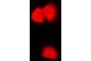 Immunofluorescent analysis of CASK staining in U2OS cells. (CASK 抗体)