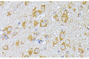 Immunohistochemistry of paraffin-embedded Mouse brain using EIF2B2 Polyclonal Antibody at dilution of 1:100 (40x lens). (EIF2B2 抗体)