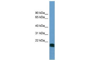 WB Suggested Anti-NT5M Antibody Titration: 0. (NT5M 抗体  (N-Term))