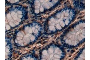 Immunohistochemistry (IHC) image for anti-Protein Kinase C, epsilon (PRKCE) (AA 403-672) antibody (ABIN7431791)