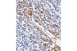 C staining LYZ in human tonsil tissue sections by Immunohistochemistry (IHC-P - paraformaldehyde-fixed, paraffin-embedded sections). (LYZ 抗体  (C-Term))