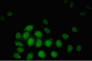 Immunofluorescent analysis of A549 cells using ABIN7172775 at dilution of 1:100 and Alexa Fluor 488-congugated AffiniPure Goat Anti-Rabbit IgG(H+L) (ZBTB33 抗体  (AA 113-228))