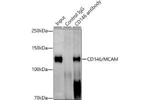 Immunoprecipitation analysis of 600 μg extracts of Mouse lung cells using 3 μg CD146/MCAM antibody (ABIN7268460). (MCAM 抗体)