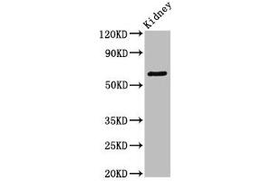 Western Blot Positive WB detected in: Mouse kidney tissue All lanes: GRK5 antibody at 3. (GRK5 抗体  (AA 406-590))