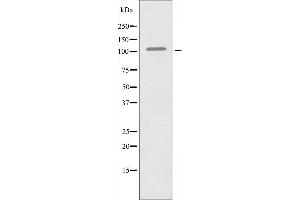Western blot analysis of extracts from COLO205 cells, using EPHA1 antibody.
