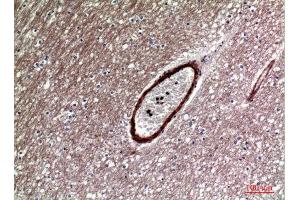 Immunohistochemistry (IHC) analysis of paraffin-embedded Human Brain, antibody was diluted at 1:100. (DKK1 抗体  (Internal Region))
