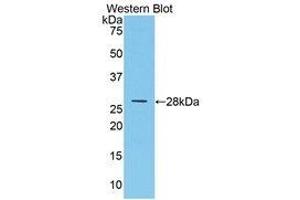 Western Blotting (WB) image for anti-Multimerin 1 (MMRN1) (AA 846-1084) antibody (ABIN1859864) (Multimerin 1 抗体  (AA 846-1084))